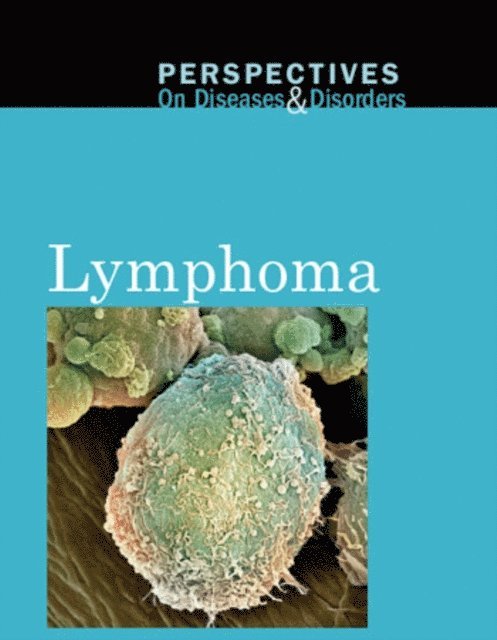 Arthur Gillard - Lymphoma, E-bok