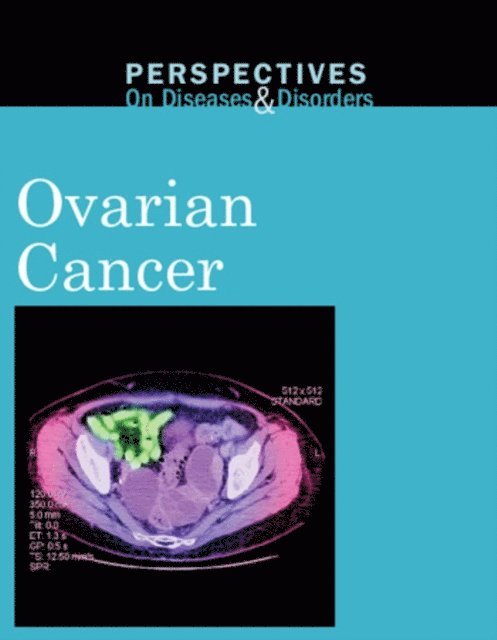 Christina Fisanick - Ovarian Cancer, E-bok