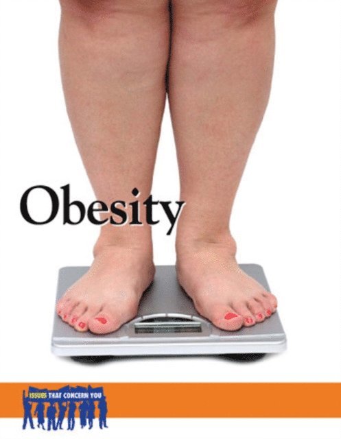 Lauri S. Scherer - Obesity, E-bok