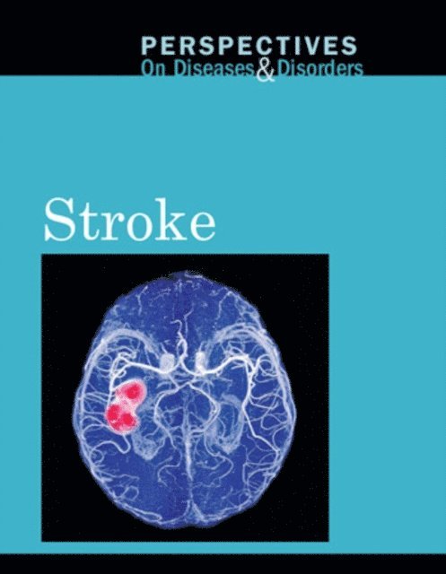 Arthur Gillard - Stroke, E-bok