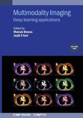 Jasjit S Suri, Mainak Biswas - Multimodality Imaging, Volume 1, Häftad
