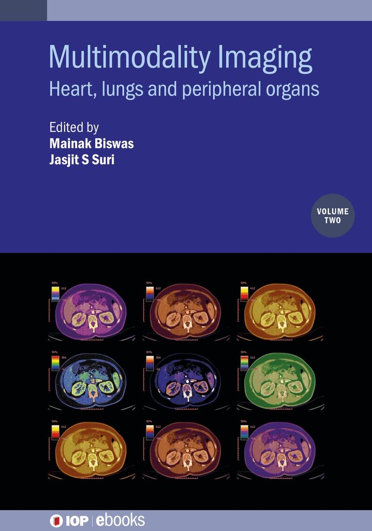 Mainak Biswas, Jasjit S Suri - Multimodality Imaging, Volume 2, Inbunden