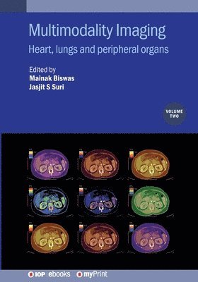 Mainak Biswas, Jasjit S Suri - Multimodality Imaging, Volume 2, Häftad