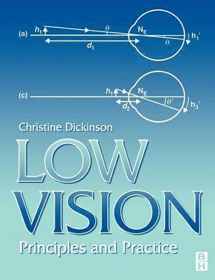 Christine Dickinson - Low Vision, Häftad. Tillgänglighet: Lägg i varukorg