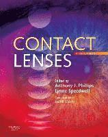 Anthony J. Phillips, Lynne Speedwell - Contact Lenses, Inbunden. Tillgänglighet: Lägg i varukorg