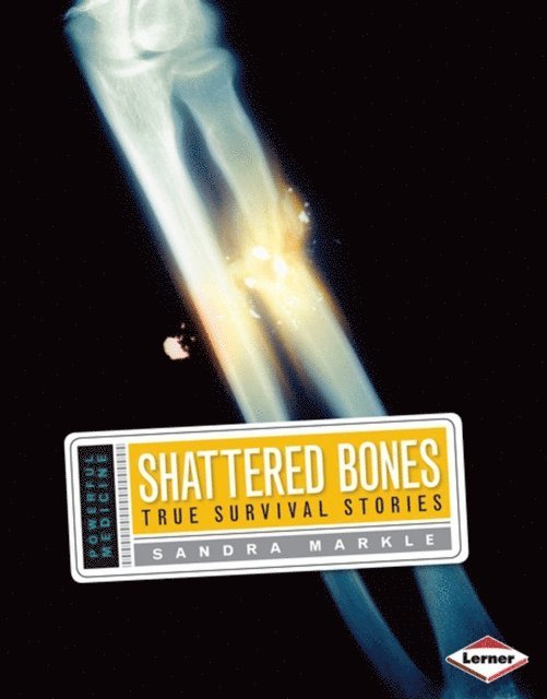 Sandra Markle - Shattered Bones, E-bok