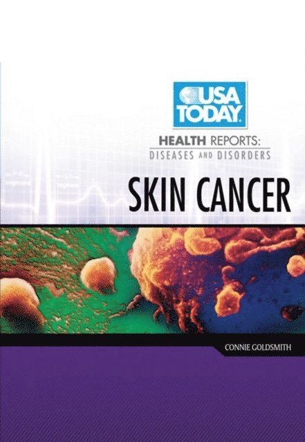 Connie Goldsmith - Skin Cancer, E-bok