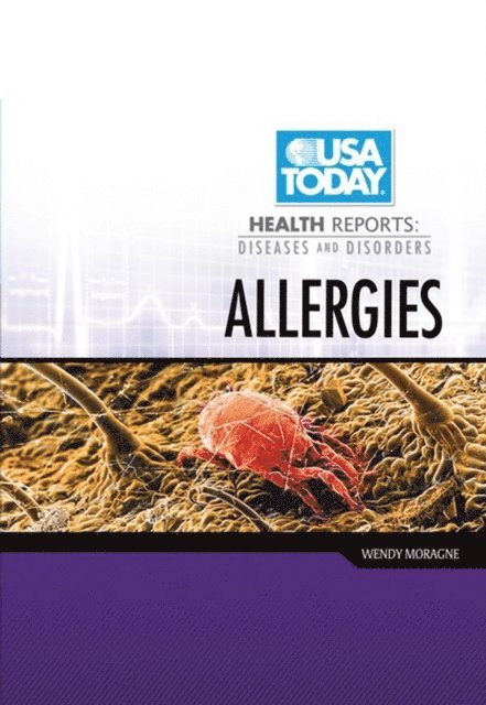 Wendy Moragne - Allergies, E-bok. Tillgänglighet: Lägg i varukorg