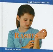 Elaine Landau - Rashes, Inbunden. Tillgänglighet: Tillfälligt slut
