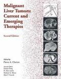 Malignant Liver Tumors