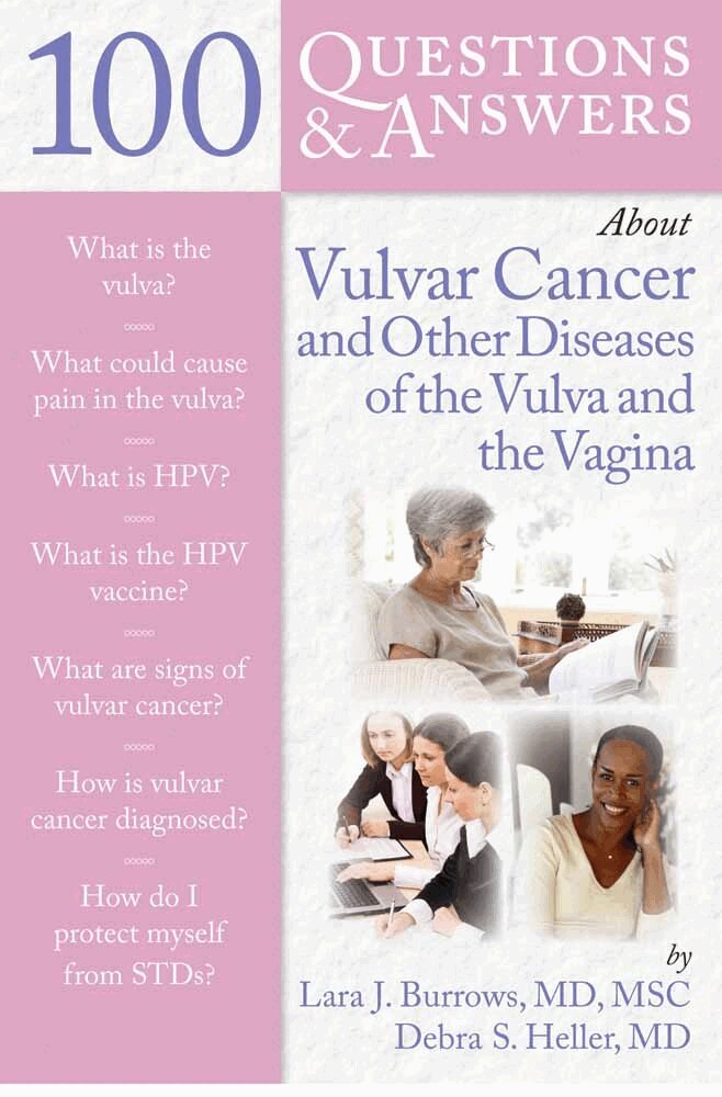 Debra S Heller, Lara J Burrows - 100 Questions & Answers About Vulvar Cancer and Other Diseases of the Vulva and Vagina, Häftad