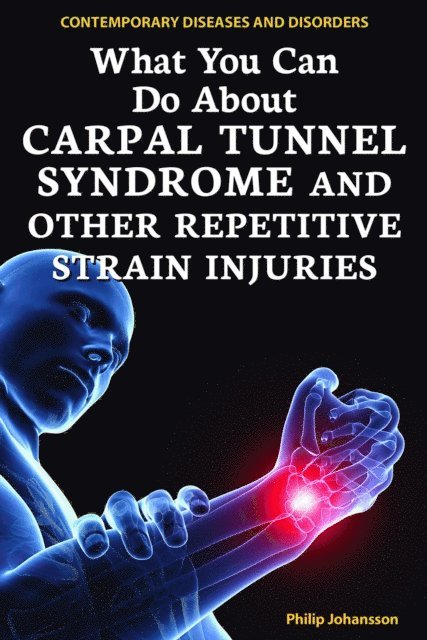 Philip Johansson - What You Can Do About Carpal Tunnel Syndrome and Other Repetitive Strain Injuries, E-bok. Tillgänglighet: Lägg i varukorg