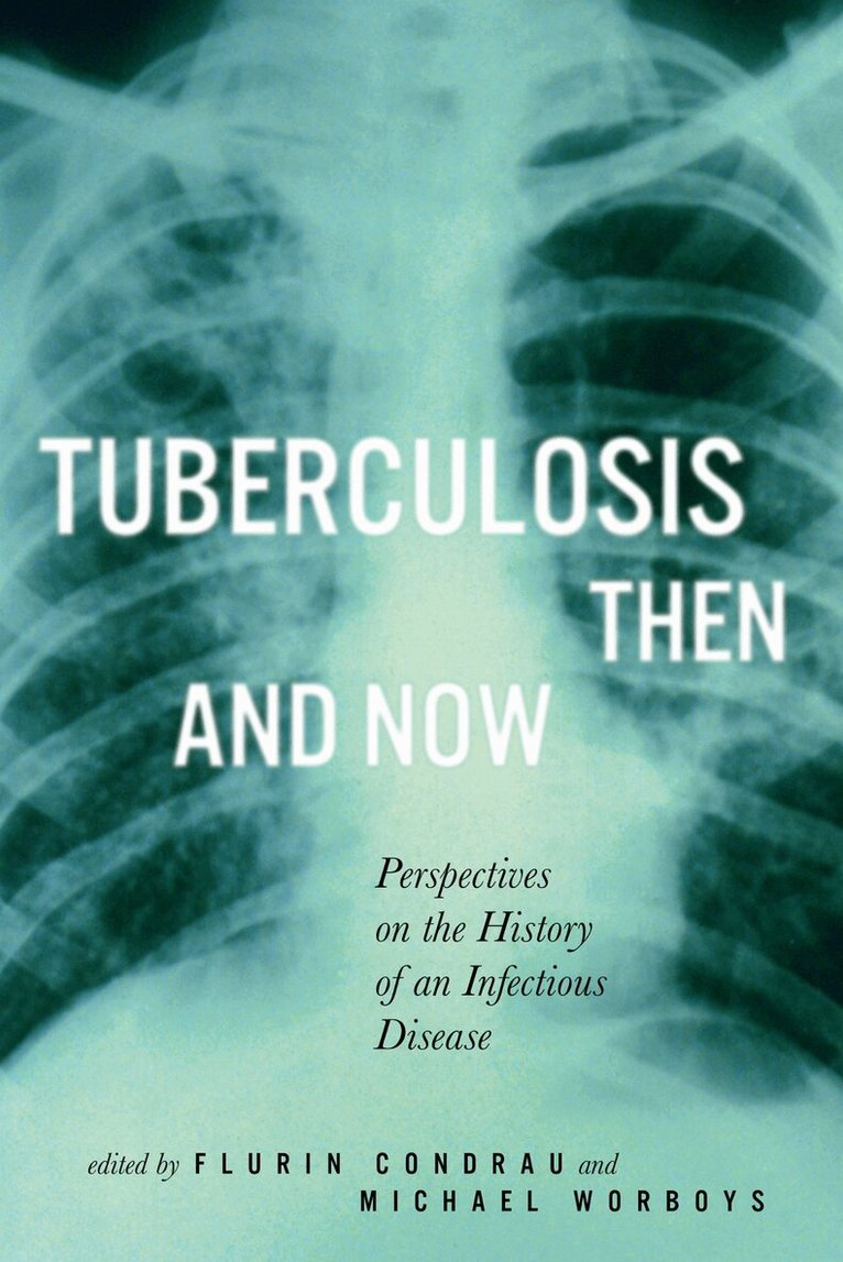 Flurin Condrau, Michael Worboys - Tuberculosis Then and Now, Häftad. Tillgänglighet: Tillfälligt slut
