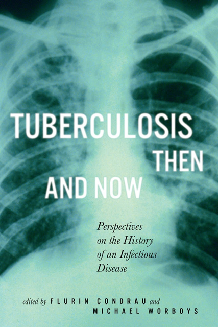 Michael Worboys, Flurin Condrau - Tuberculosis Then and Now, E-bok
