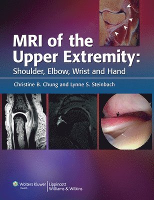 Christine B. Chung, Lynne S. Steinbach - MRI of the Upper Extremity : Shoulder, Elbow, Wrist and Hand, Inbunden. Tillgänglighet: Tillfälligt slut