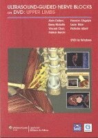 Ultrasound-Guided Nerve Blocks on DVD Set of 2 DVDs av Delbos
