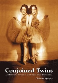 Conjoined Twins