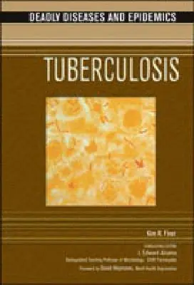 Kim R. Finer - Tuberculosis, Inbunden. Tillgänglighet: Tillfälligt slut