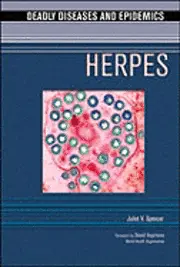 Juliet V. Spencer - Herpes, Inbunden. Tillgänglighet: Tillfälligt slut
