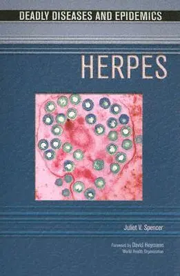 Juliet V. Spencer - Herpes, Häftad. Tillgänglighet: Tillfälligt slut