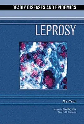 Alfica Sehgal - Leprosy, Inbunden. Tillgänglighet: Tillfälligt slut