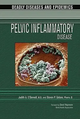 Judith O'Donnell - Pelvic Inflammatory Disease, Inbunden. Tillgänglighet: Tillfälligt slut
