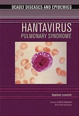 Stephanie Leuenroth - Hantavirus Pulmonary Syndrome, Inbunden. Tillgänglighet: Tillfälligt slut