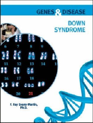 F. Fay Evans-Martin - Down Syndrome, Inbunden. Tillgänglighet: Lägg i varukorg