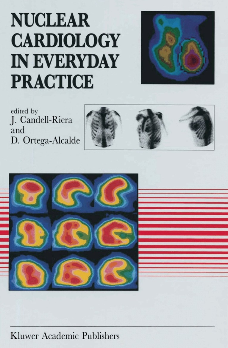 Nuclear Cardiology in Everyday Practice