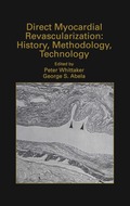 Direct Myocardial Revascularization: History, Methodology, Technology