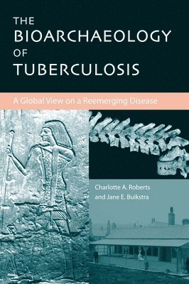 Jane E. Buikstra, Charlotte A. Roberts - Bioarchaeology of Tuberculosis, E-bok