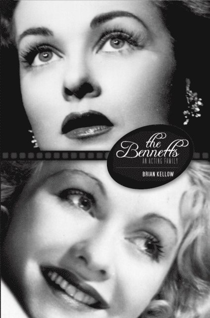 Bennetts
