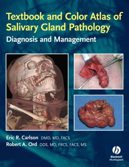 Robert Ord, Eric R. Carlson - Textbook and Color Atlas of Salivary Gland Pathology, E-bok