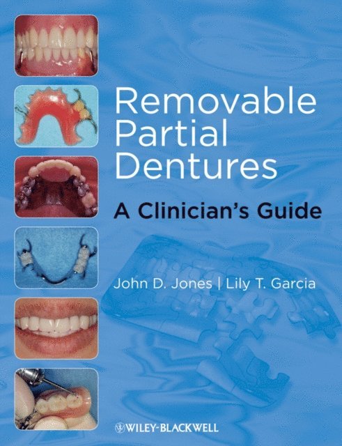 Lily T. Garc a, John D. Jones - Removable Partial Dentures, E-bok