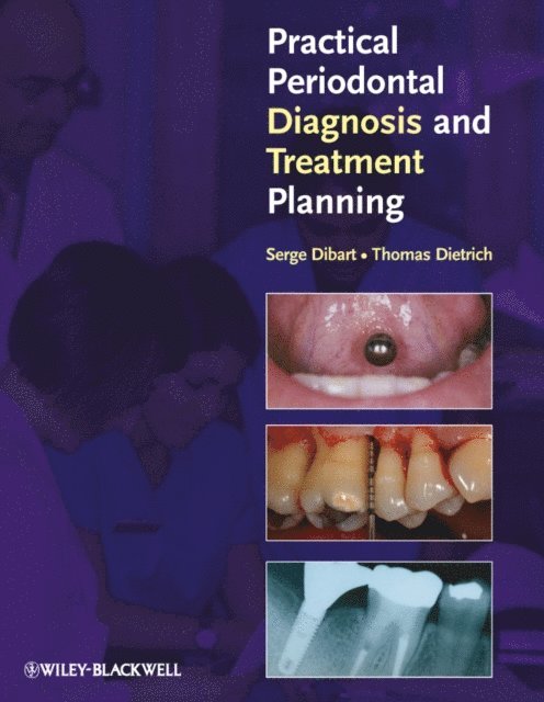 Serge Dibart, Thomas Dietrich - Practical Periodontal Diagnosis and Treatment Planning, E-bok