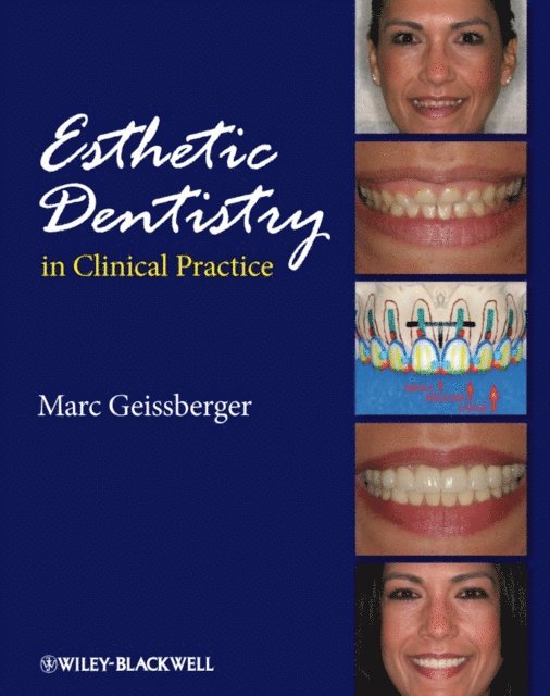 Marc Geissberger - Esthetic Dentistry in Clinical Practice, E-bok