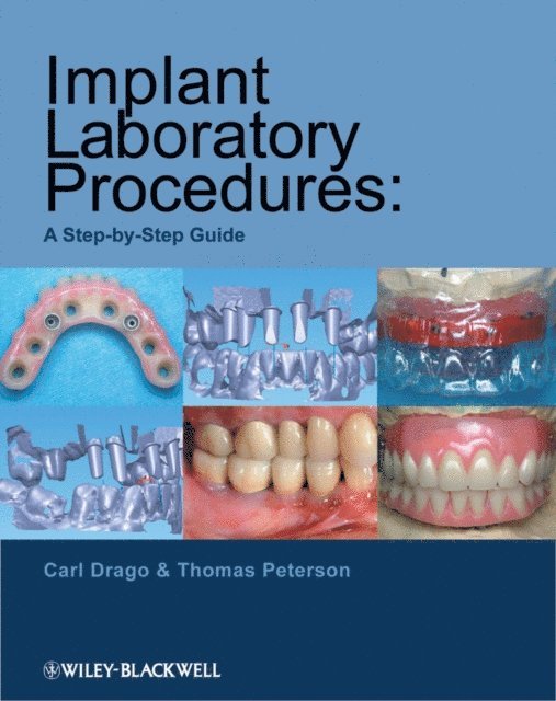 Thomas Peterson, Carl Drago - Implant Laboratory Procedures, E-bok
