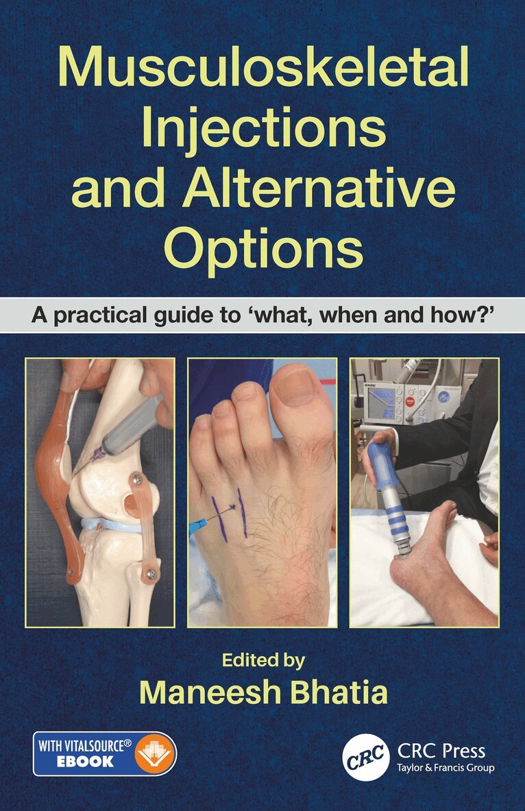 Maneesh Bhatia - Musculoskeletal Injections and Alternative Options, Häftad. Tillgänglighet: Lägg i varukorg