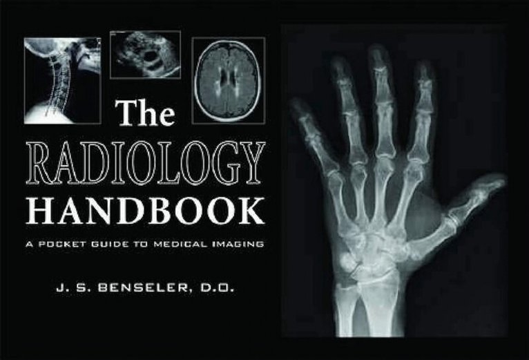 J. S. Benseler - Radiology Handbook, Häftad. Tillgänglighet: Lägg i varukorg