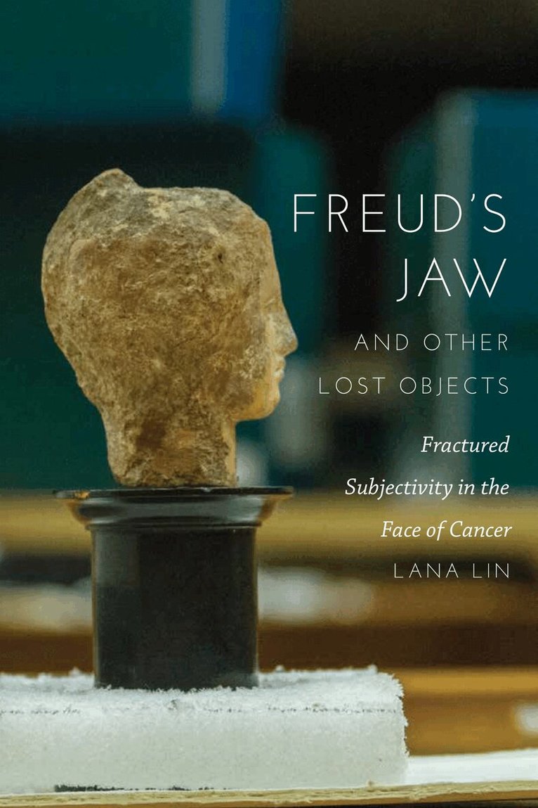 Lana Lin - Freud's Jaw and Other Lost Objects, Inbunden