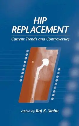Raj K. Sinha - Hip Replacement, Inbunden. Tillgänglighet: Lägg i varukorg
