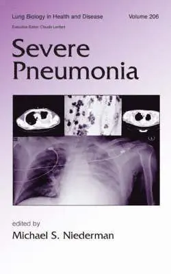 Michael S. Niederman - Severe Pneumonia, Inbunden. Tillgänglighet: Tillfälligt slut