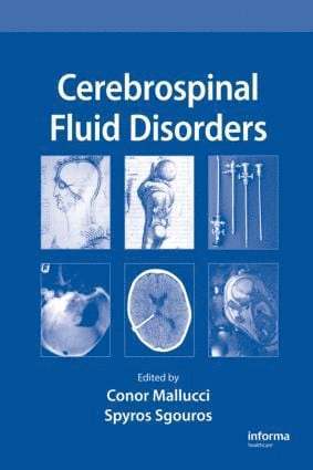 Conor Mallucci, Spyros Sgouros - Cerebrospinal Fluid Disorders, Inbunden
