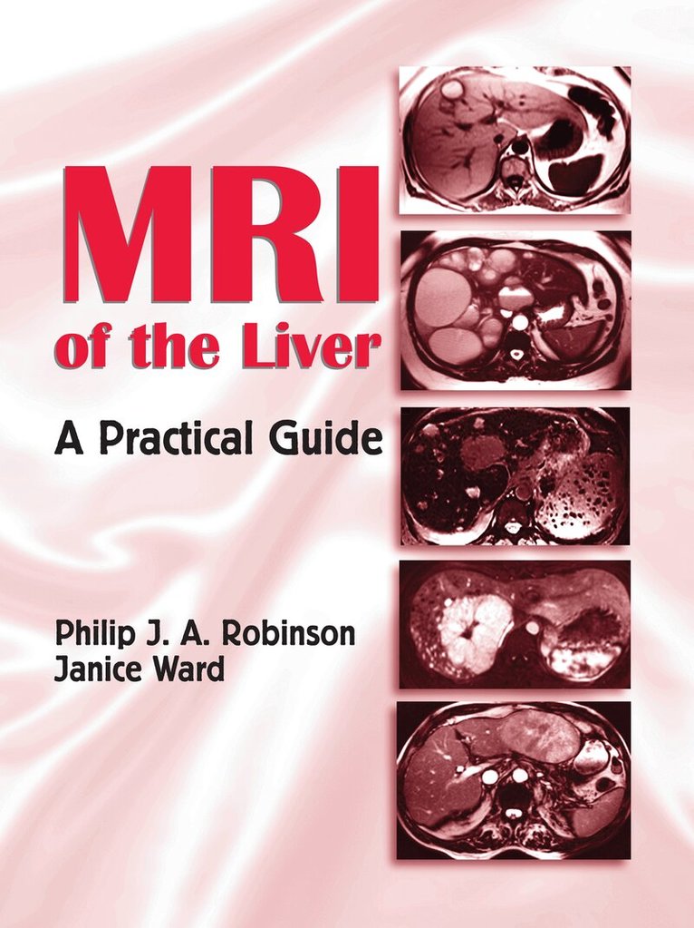 Philip J. A. Robinson, Janice Ward - MRI of the Liver, Inbunden. Tillgänglighet: Tillfälligt slut