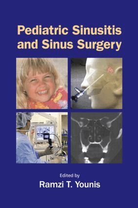 Ramzi T. Younis - Pediatric Sinusitis and Sinus Surgery, Inbunden. Tillgänglighet: Lägg i varukorg