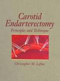 Carotid Endarterectomy