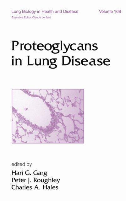 Hari G. Garg - Proteoglycans in Lung Disease, E-bok