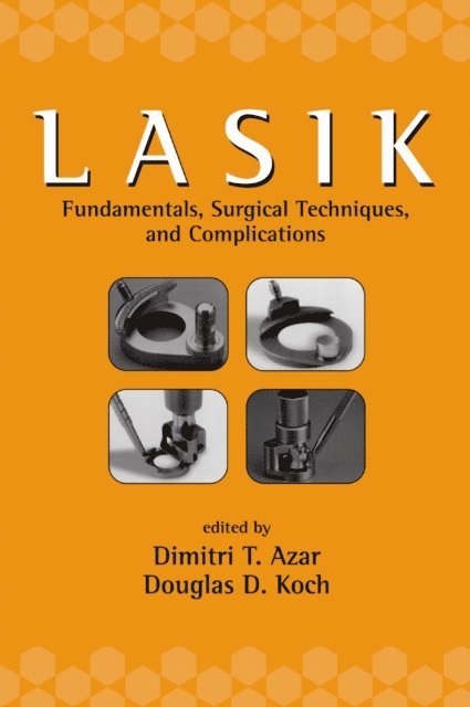 Douglas Koch, Dimitri T. Azar - LASIK (Laser in Situ Keratomileusis), E-bok