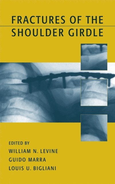 Guido Marra, William N. Levine - Fractures of the Shoulder Girdle, E-bok
