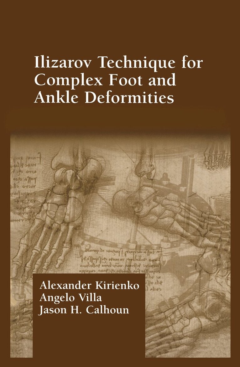 Alexander Kirienko - Ilizarov Technique for Complex Foot and Ankle Deformities, Inbunden. Tillgänglighet: Lägg i varukorg
